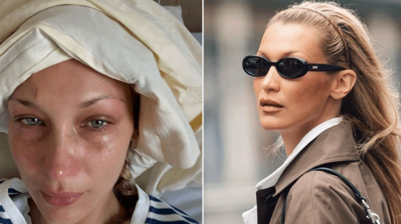 Bella Hadid rrëfen betejën me ankthin dhe depresionin, me një mesazh mbështetjeje