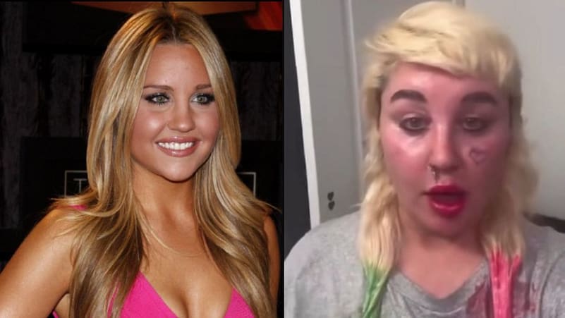 Nga Ylli i Ekranit në Luftë Personale: Udha e Vështirë e Amanda Bynes